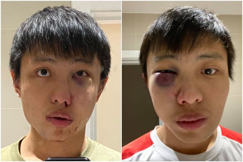 Singapore student assault sparked by COVID-19 comments