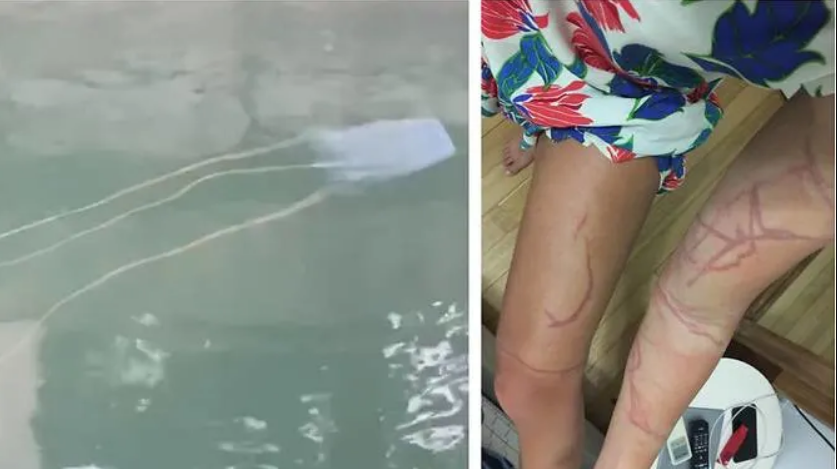 Beach-goers and swimmers at various locations advised to be alert after sightings of dangerous box jellyfish