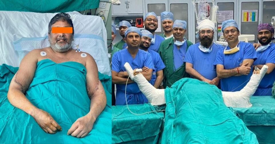 indian man-arm-transplant-